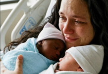 Blizanci sa različitim bojama kože – Istina koja je potresla celu porodicu