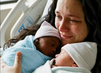 Blizanci sa različitim bojama kože – Istina koja je potresla celu porodicu