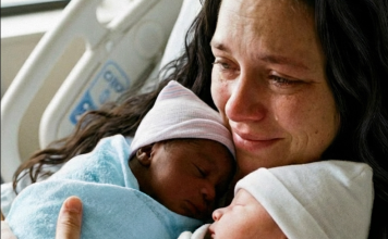 Blizanci sa različitim bojama kože – Istina koja je potresla celu porodicu