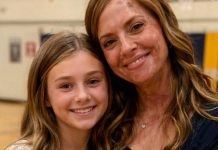 “Zbog mojih ožiljaka, ćerka me molila da ne dolazim u školu”