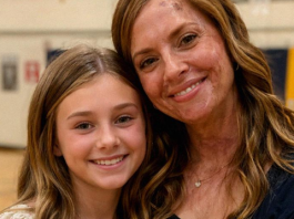 “Zbog mojih ožiljaka, ćerka me molila da ne dolazim u školu”